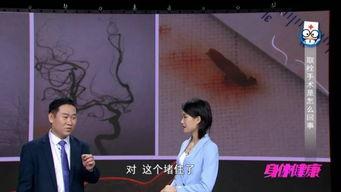 取栓视频,取栓手术全过程揭秘